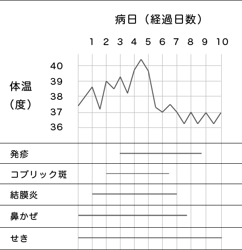 はしか(麻疹)の経過